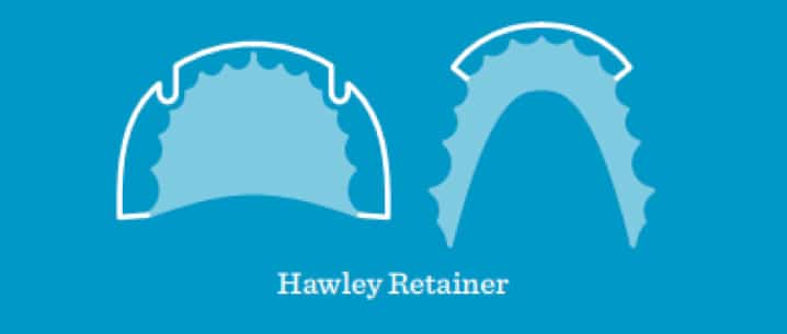 Hawley Retainers